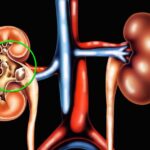 best Nephrologist in Karachi