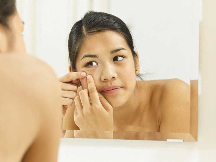 Facial Cysts and What You Can Do About Them