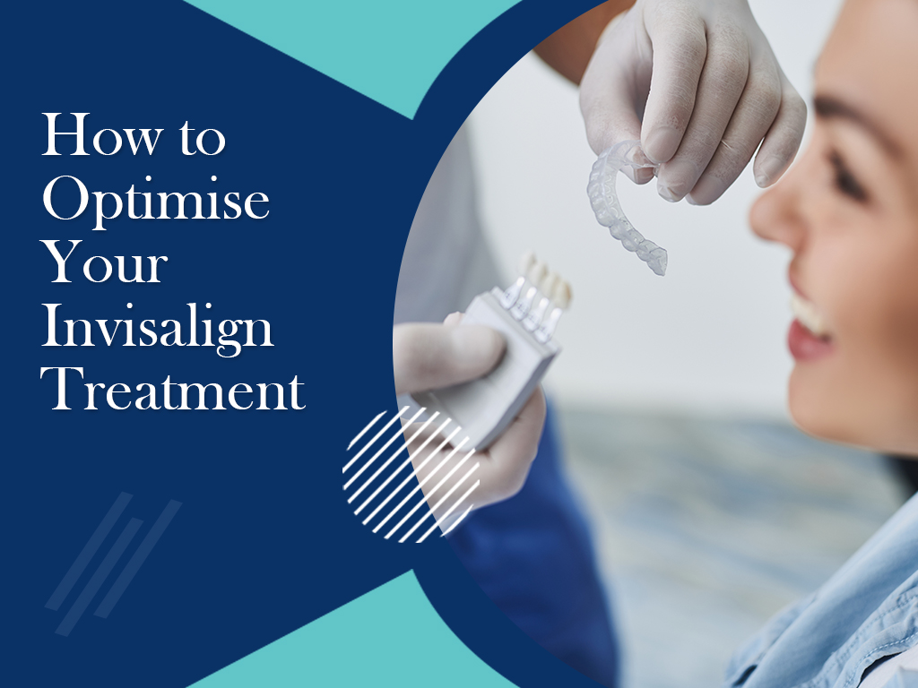 How to optimise your Invisalign treatment - Healthy Tips Forever