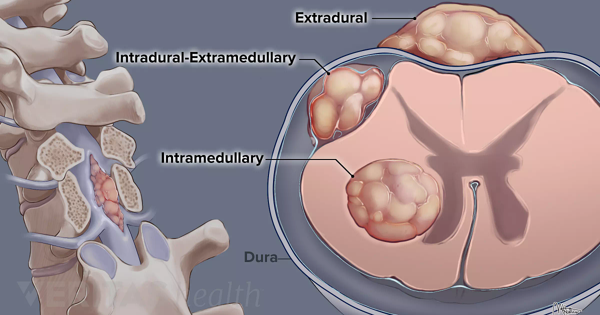 What Is The Reason To Cause Cancer Disease?