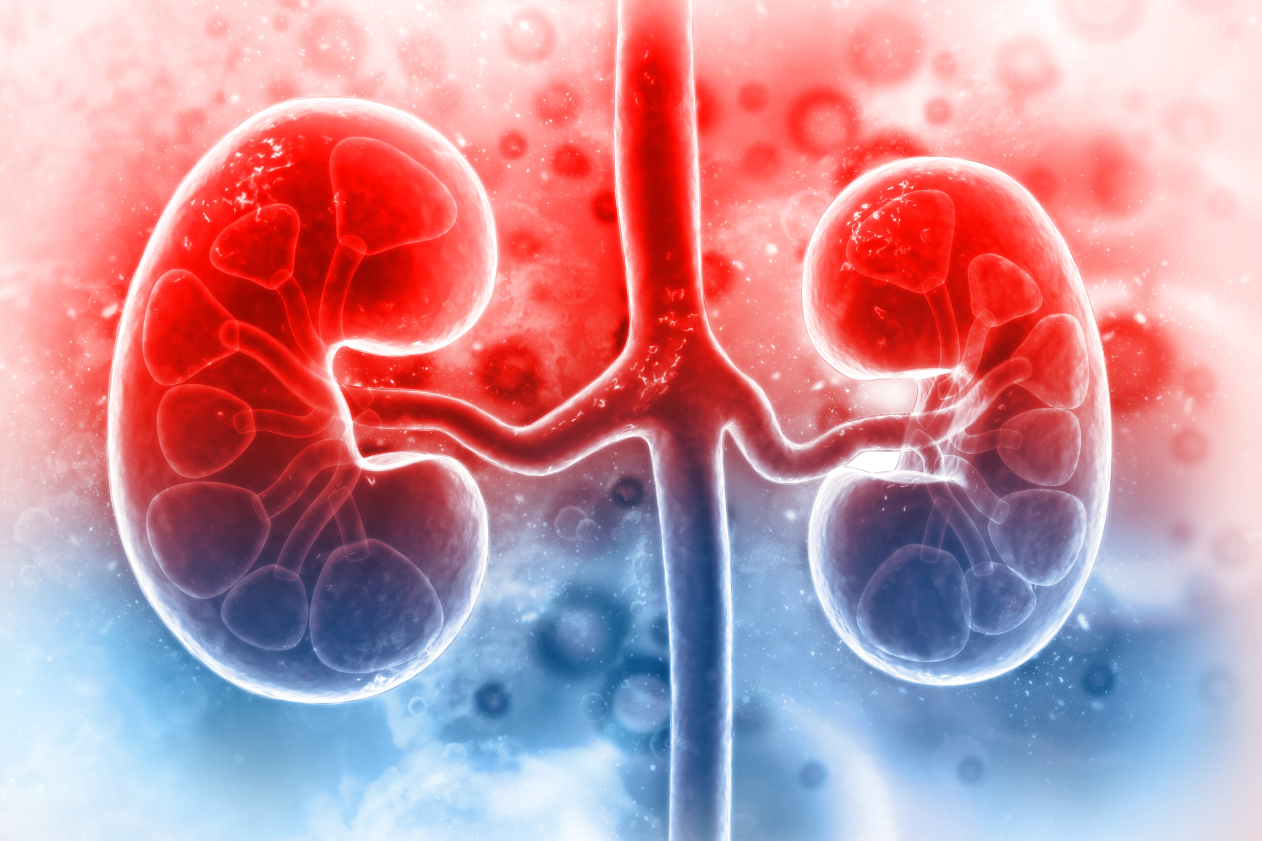 What is chronic kidney failure?