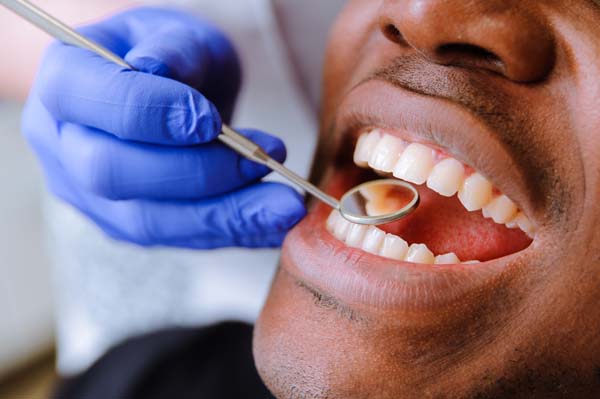 Reasons Why Visiting a Dentist Is Good Dental Care Practice