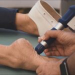 Treating Plantar Fasciitis With Shockwave Therapy