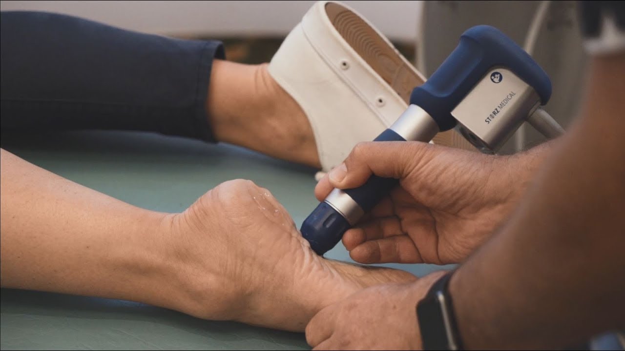 Treating Plantar Fasciitis With Shockwave Therapy
