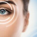 5 Things You Should Know About Lasik Eye Surgery