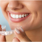 Seven Benefits Of Using Invisalign