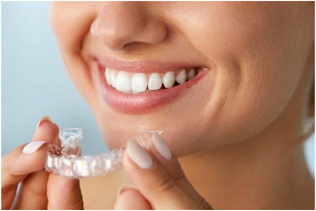 Seven Benefits Of Using Invisalign