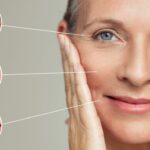 ThermageFX & Thermage FLX: A Revolutionary Approach to Skin Tightening