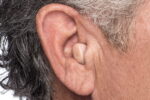 In Canal Hearing Aids